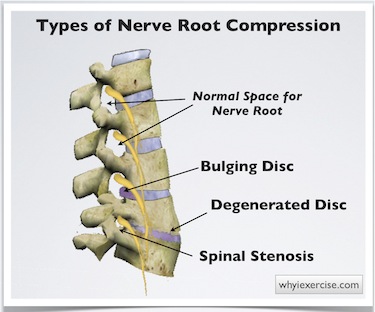 Severe Pain In Lower Back